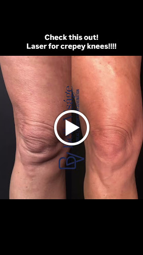 Explore gta san andreas tattoo ideas, creative tattoo ideas in Lakeland, available at Bella Visge Medical & Aesthetic Rejuvenation