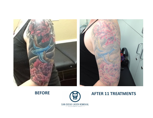 Explore simple black tattoo ideas, creative tattoo ideas in San Diego, available at Removery Tattoo Removal & Fading