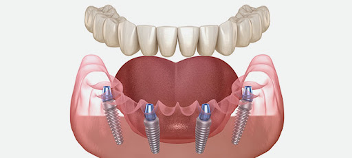 MySmile Dental Care