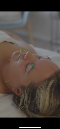 Acuworld - Photo 6 - Car repair in Naples, FL, Bonita Springs