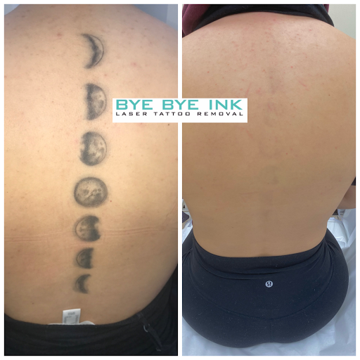 Explore labyrinth tattoo ideas, creative tattoo ideas in Middle Village, available at Bye Bye Ink Laser Tattoo Removal