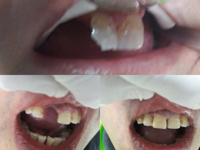 Comentarios y opiniones de Clínica Dental Odontodent San Bernardo