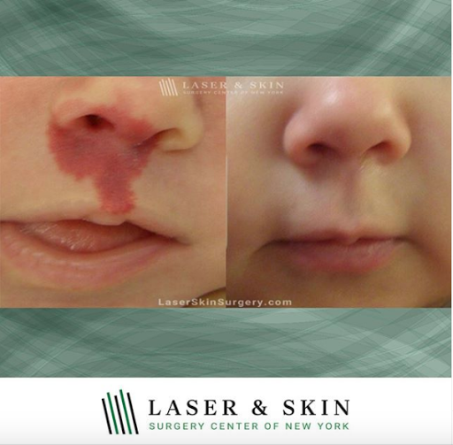 Explore sea life tattoo ideas, creative tattoo ideas in Southampton, available at Laser & Skin Surgery Center of New York - Southampton