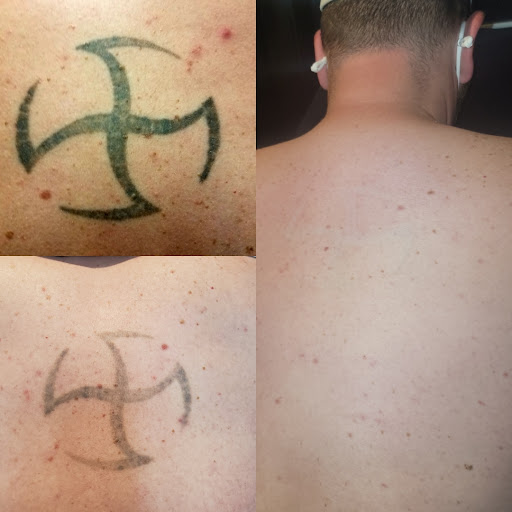 Explore 1985 tattoo ideas, creative tattoo ideas in Dubuque, available at Retrospect Tattoo Removal