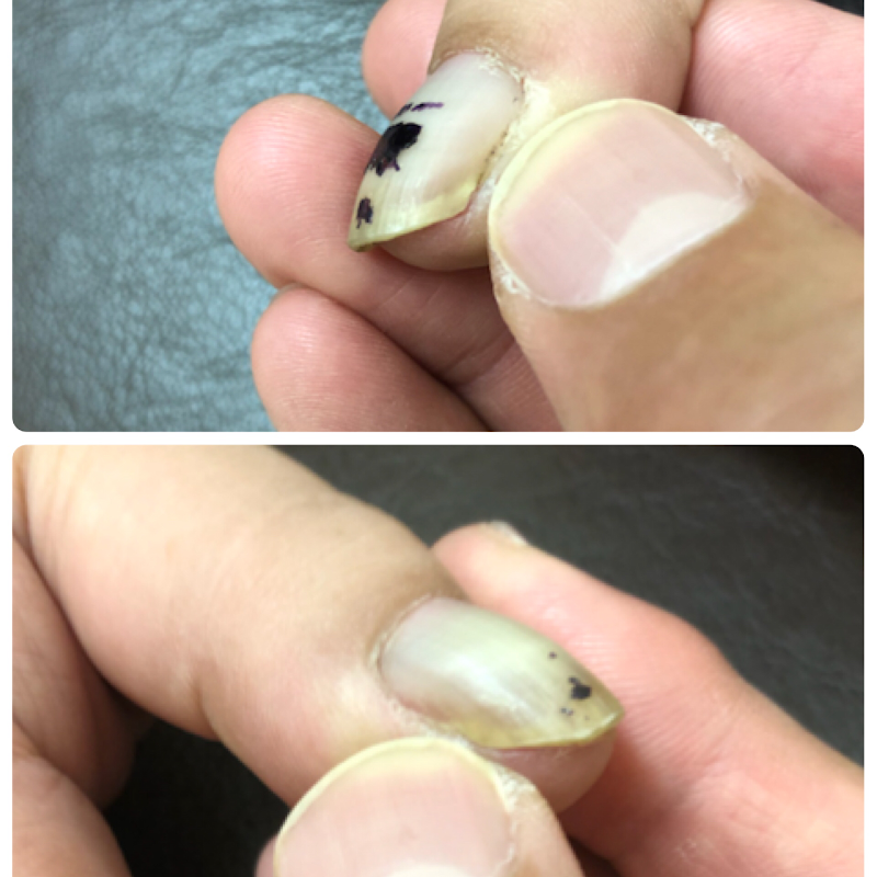 巻き爪じゅん 千葉駅前店 千葉県千葉市中央区新千葉 病院 グルコミ