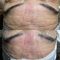 Brilla Esthetics - Photo 6 - Car repair in Salinas, CA, Salinas