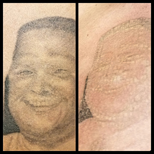 Explore pharmacy tattoo ideas, creative tattoo ideas in Dubuque, available at Retrospect Tattoo Removal