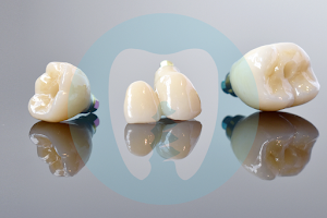 Perth Dental Implant Centre image