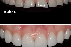 Smile Recreation Dentistry, Porcelain Veneers, Invisalign, Root Canals, periodontics, Oral Surgery, and Emergency Dentistry image