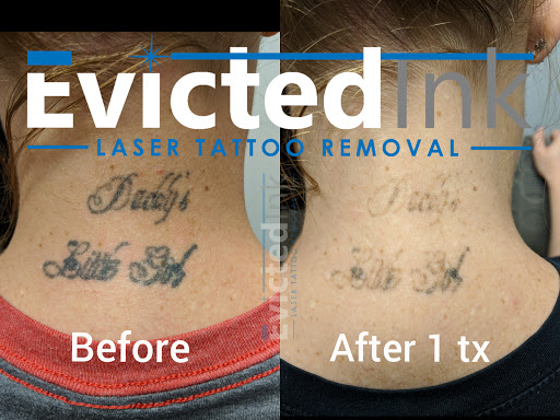 Explore back of knee tattoo ideas, creative tattoo ideas in Wichita, available at Evicted Ink Laser Tattoo Removal