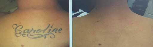 Explore tattoo ideas for wrist for guys, creative tattoo ideas in Houston, available at Houston Tattoo Removal Clinic