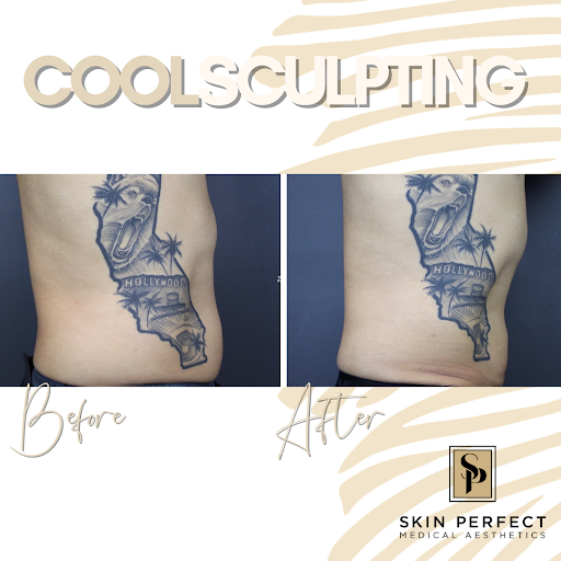 Explore hakuna matata tattoo ideas, creative tattoo ideas in Whittier, available at Skin Perfect Medical Aesthetics