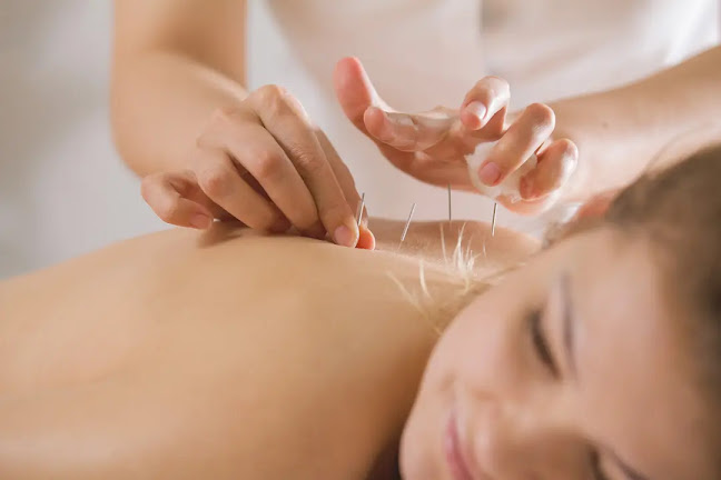 NUWA TCM Praxis Laufen/BL für Akupunktur Traditionelle Chinesische Medizin Massage Kräutertherapie Schröpfen - Akupunkteur