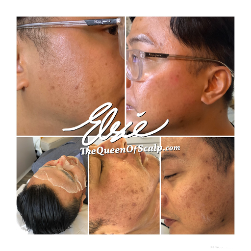 SMP Hair Clinic The Queen Of Scalp image