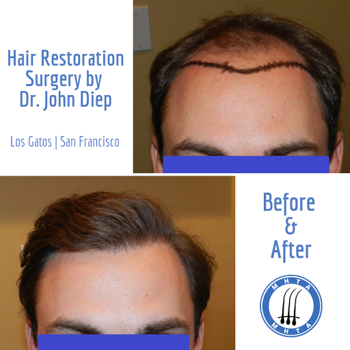 Hair Replacement Service «Medical Hair Transplants & Aesthetics», reviews and photos, 15055 Los Gatos Blvd Suite #110, Los Gatos, CA 95032, USA
