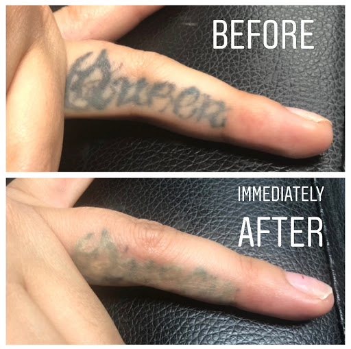 Explore i am the storm tattoo ideas, creative tattoo ideas in San Diego, available at Removery Tattoo Removal & Fading