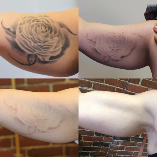 Explore floral sleeve tattoo ideas, creative tattoo ideas in Orlando, available at Removery Tattoo Removal & Fading