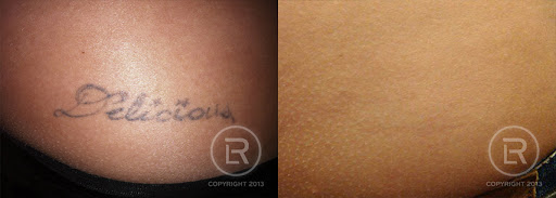 Explore cross tattoo ideas small, creative tattoo ideas in Rochester, available at Renewal Laser Clinic