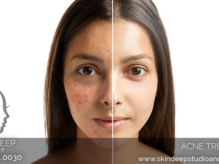 Skin Deep Studio 91201