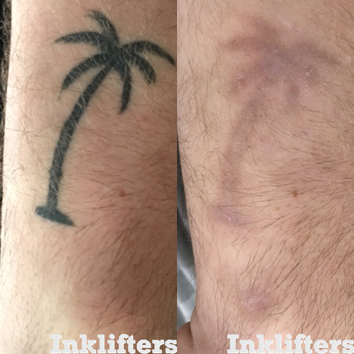 Find buck tattoo ideas for your next unique tattoo in Pleasant Grove at Inklifters Tattoo Removal