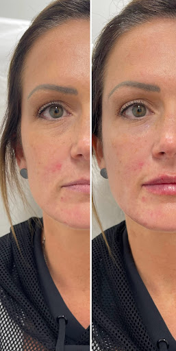 Explore virgo tattoo ideas for females, creative tattoo ideas in Owensboro, available at The Skin Lab