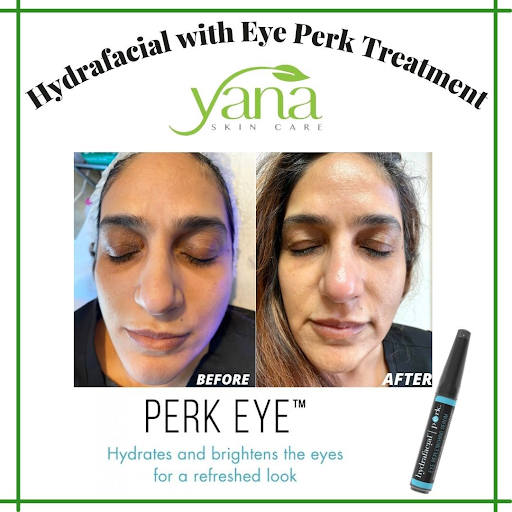 Laser Hair Removal Service «Yana Skin Care», reviews and photos, 3101 Richmond Ave #200, Houston, TX 77098, USA