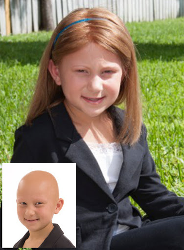 Hair Replacement Service «Elite Solutions Hair Loss Specialists of Sacramento», reviews and photos, 9294 Madison Ave, Orangevale, CA 95662, USA