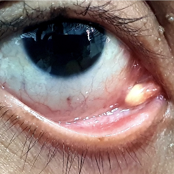 OPTICA KLEM VISION SAS