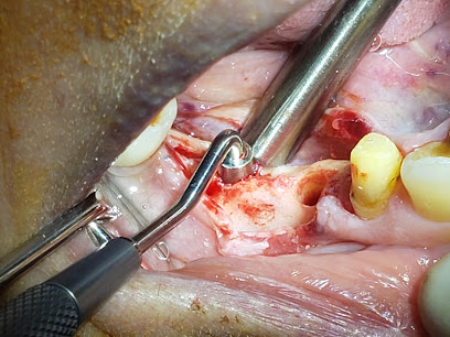 Salemme Alonso Leandro Implantes Dentales Rehabilitacion Oral