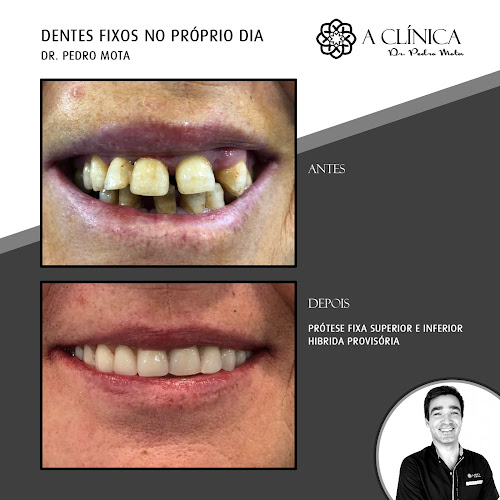 Avaliações doA Clínica Dr. Pedro Mota em Vila Franca de Xira - Dentista