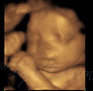 Baby Envision 4D Ultrasound of Troy image 4