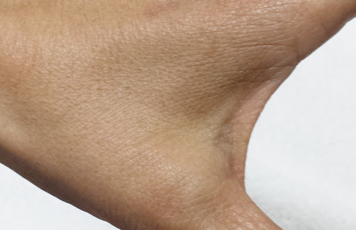 Explore colorado flag tattoo ideas, creative tattoo ideas in Springfield, available at Under My Skin Tattoo Removal