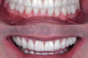 Dentista - Dra. Giovana Urso em Cerquilho | Lentes de Contato Dental | Tratamento de Canal com Microscópio image
