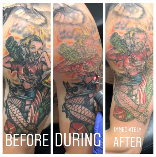 Explore marker tattoo ideas, creative tattoo ideas in San Diego, available at Removery Tattoo Removal & Fading