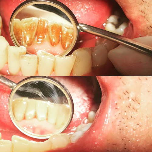 Avaliações doClínica Dentária Monte Abraão em Sintra - Dentista