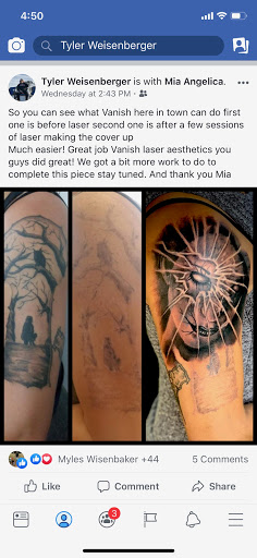 Explore filler tattoo ideas, creative tattoo ideas in Longview, available at Vanish Laser Aesthetics