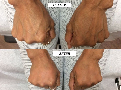 Find best travel tattoo ideas for your next unique tattoo in Lake Oswego at Lake Oswego Vein and Aesthetic LOVA