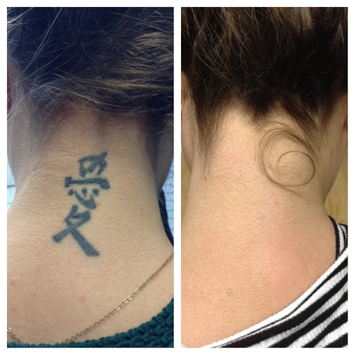 Explore mid arm tattoo ideas, creative tattoo ideas in Lawrence, available at Removery Tattoo Removal & Fading