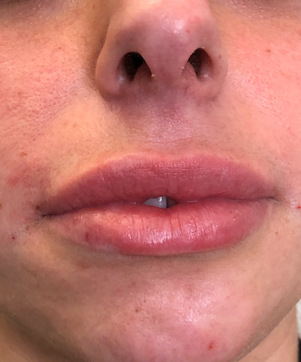 Explore ares god of war tattoo ideas, creative tattoo ideas in Summit, available at Ethos Aesthetics and Wellness, Laser Hair Removal and Med Spa