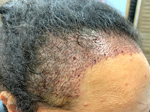 Modena Hair Transplant Institute image