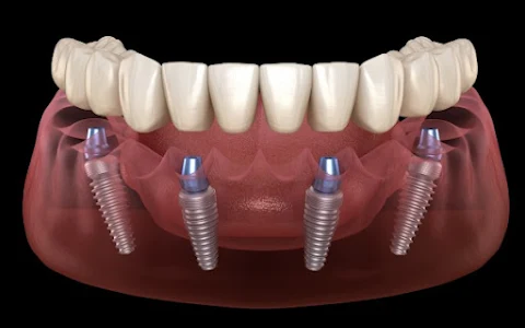 Dental Implantologist UAE image