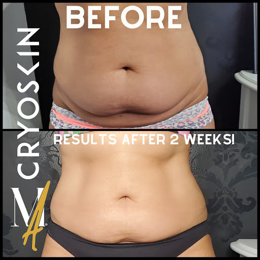 Explore tattoo ideas female back, creative tattoo ideas in Oak Park, available at Microblading Oak Park by Moxie Allure