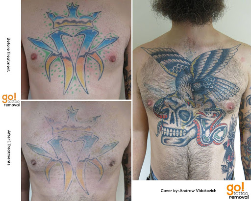 Explore autumn tattoo ideas, creative tattoo ideas in Allentown, available at Removery Tattoo Removal & Fading
