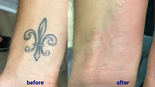 Explore trumpet tattoo ideas, creative tattoo ideas in Sheffield Lake, available at TakeTatt Tattoo Removal