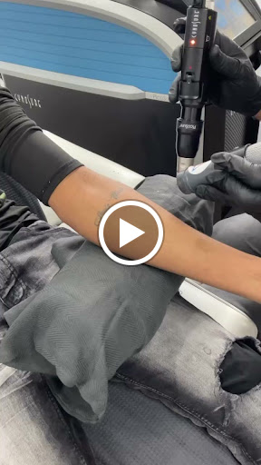 Explore complex tattoo ideas, creative tattoo ideas in New York, available at Ag2g Laser Tattoo Removal & MedSpa