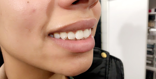 Explore thyroid tattoo ideas, creative tattoo ideas in Providence, available at Kissed by a Needle