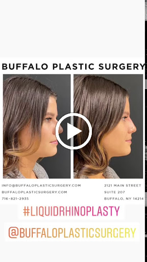 Buffalo Plastic Surgery image 9
