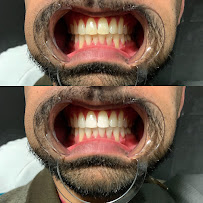 Simply Glowing - Photo 9 - Car repair in Linden, NJ, Elizabeth