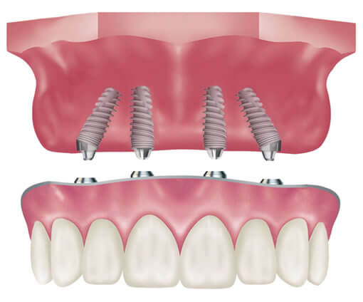Designer Smiles Dental and Implant Center