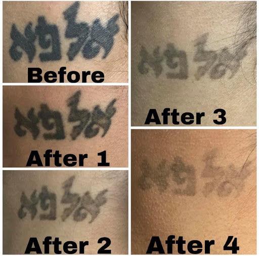 Explore name sleeve tattoo ideas, creative tattoo ideas in Pinellas Park, available at St Pete Tattoo Removal